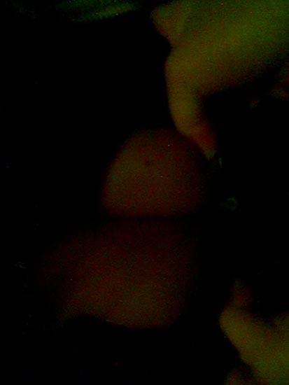 Foto(18)